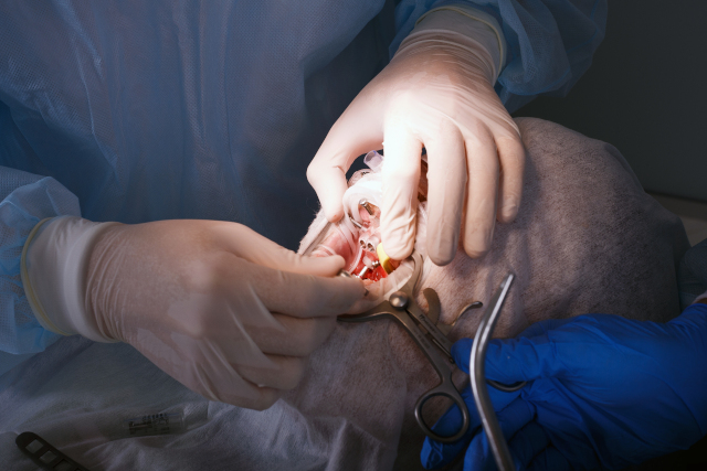 Dental Bone Graft Surgery