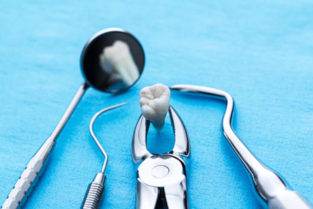long term effects of tooth extraction