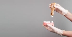 dental procedures