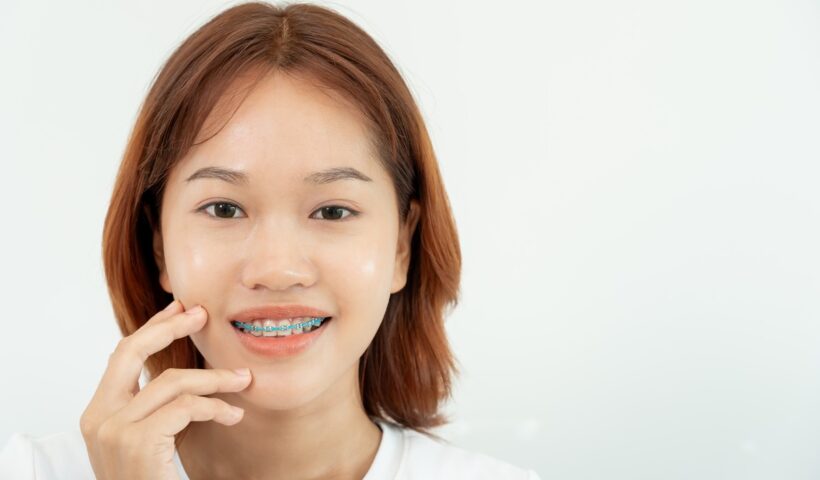 how long do you have to wear a retainer
